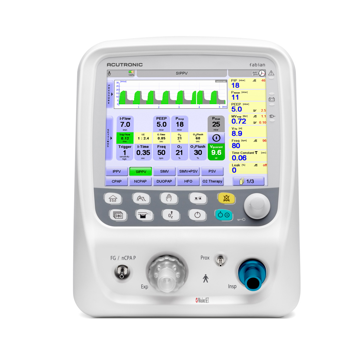 Medisinsk respirator med digital skjerm som viser pustemønstre og ulike innstillinger og måleverdier.