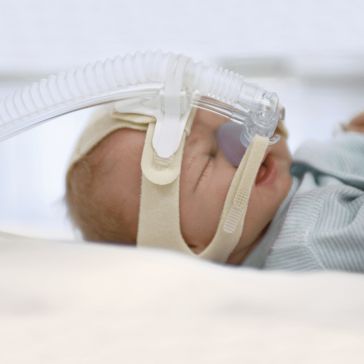 Nyfödd bebis som bär en nasal CPAP-mask för assisterad andning, liggande på en sjukhussäng.