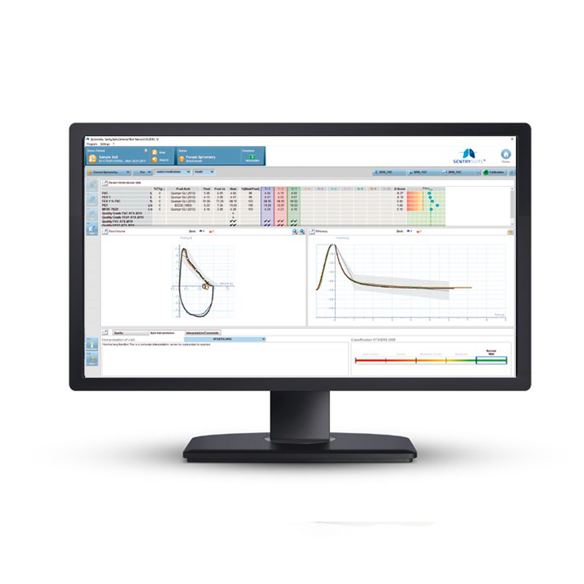 Dataskjerm som viser vitenskapelig analyseteknologi med ulike grafer, diagrammer og datatabeller på skjermen.