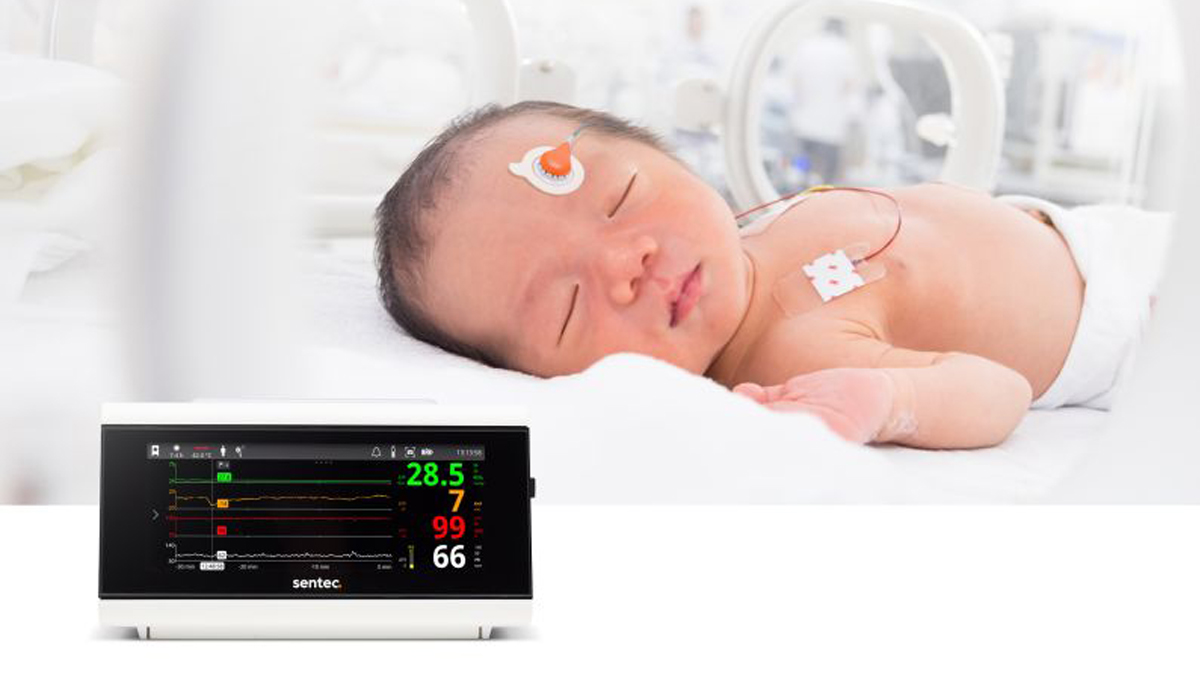 Nyfödd bebis i en kuvös med sensorer fästa, bredvid en medicinsk monitor som visar vitala tecken.